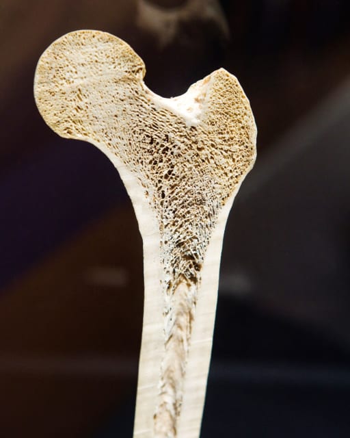 Why can't we design or manufacture like Nature does? A section of a human femur head shows irregular, optimized cell structure. Stock photo.